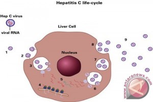 Hepatitis Hepatitis