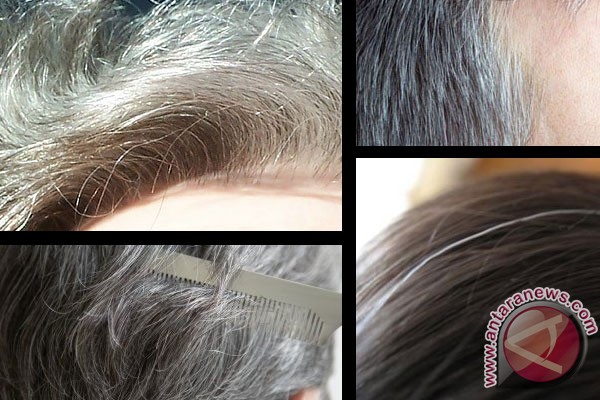 Cara alami atasi rambut beruban Cara alami atasi rambut beruban