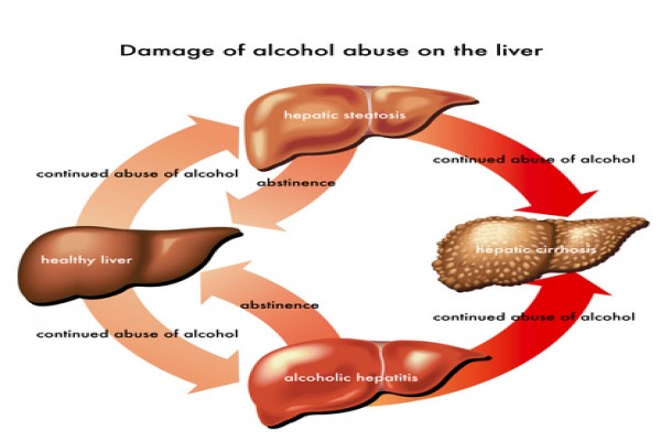 scientists-find-way-to-prevent-alcohol-damage-to-liver-antara-news