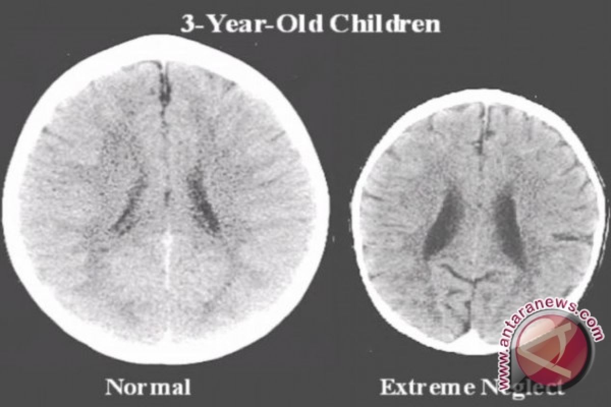 CT Scan Murjani Rusak Akibat Gangguan Listrik 