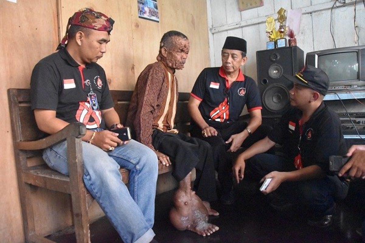 "Manusia Pohon" Wonosobo Jadi Tulang Punggung Keluarga