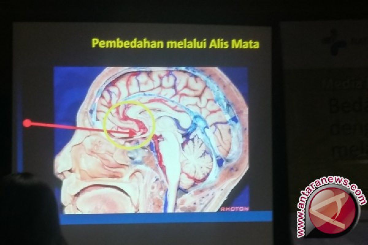 Operasi tumor otak kini bisa melalui alis mata