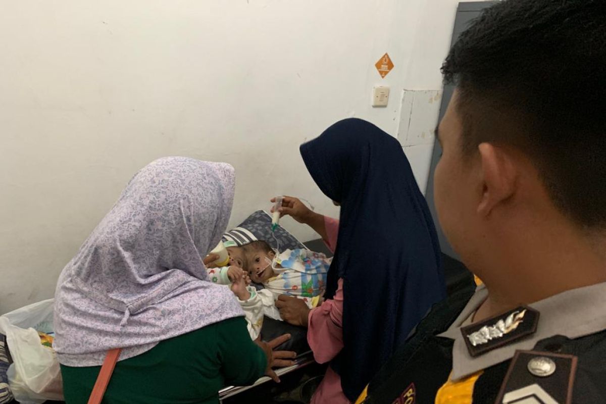 Fadli Fadlan, bayi kembar siam dirawat intensif di RSUD Cianjur