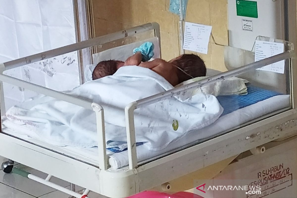 Warga Pangkalan Bun lahirkan bayi kembar siam dempet dada dan perut