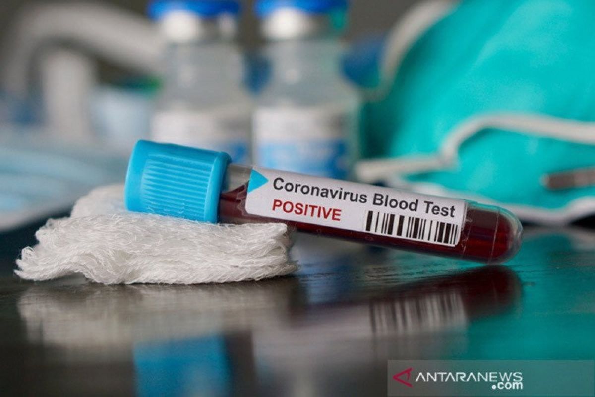 Pakar prediksi wabah virus corona di Indonesia berakhir Mei asal masyarakat disiplin lakukan hal ini