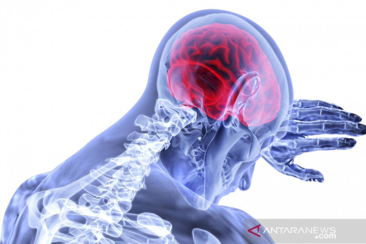 Angka kematian stroke bisa turun jika pasien cepat tertangani