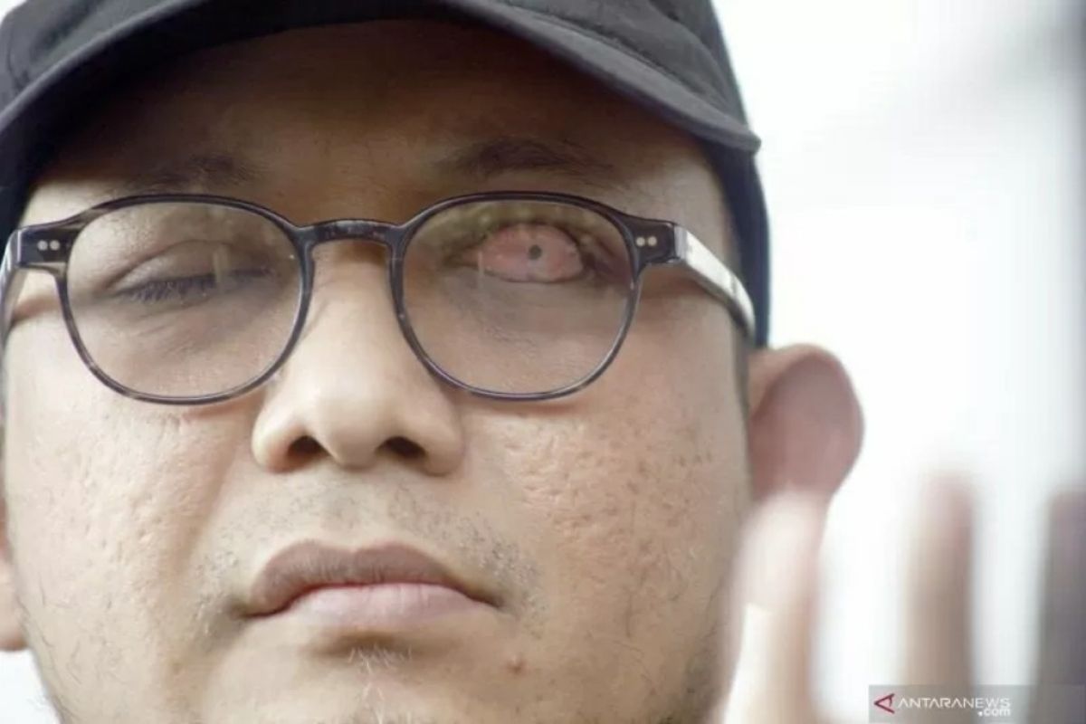 Istri dan empat anak Novel Baswedan juga positif COVID-19