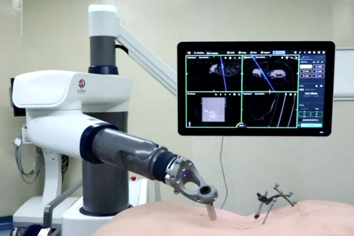 Eka hospital hadirkan robot navigasi pertama obati skoliosis