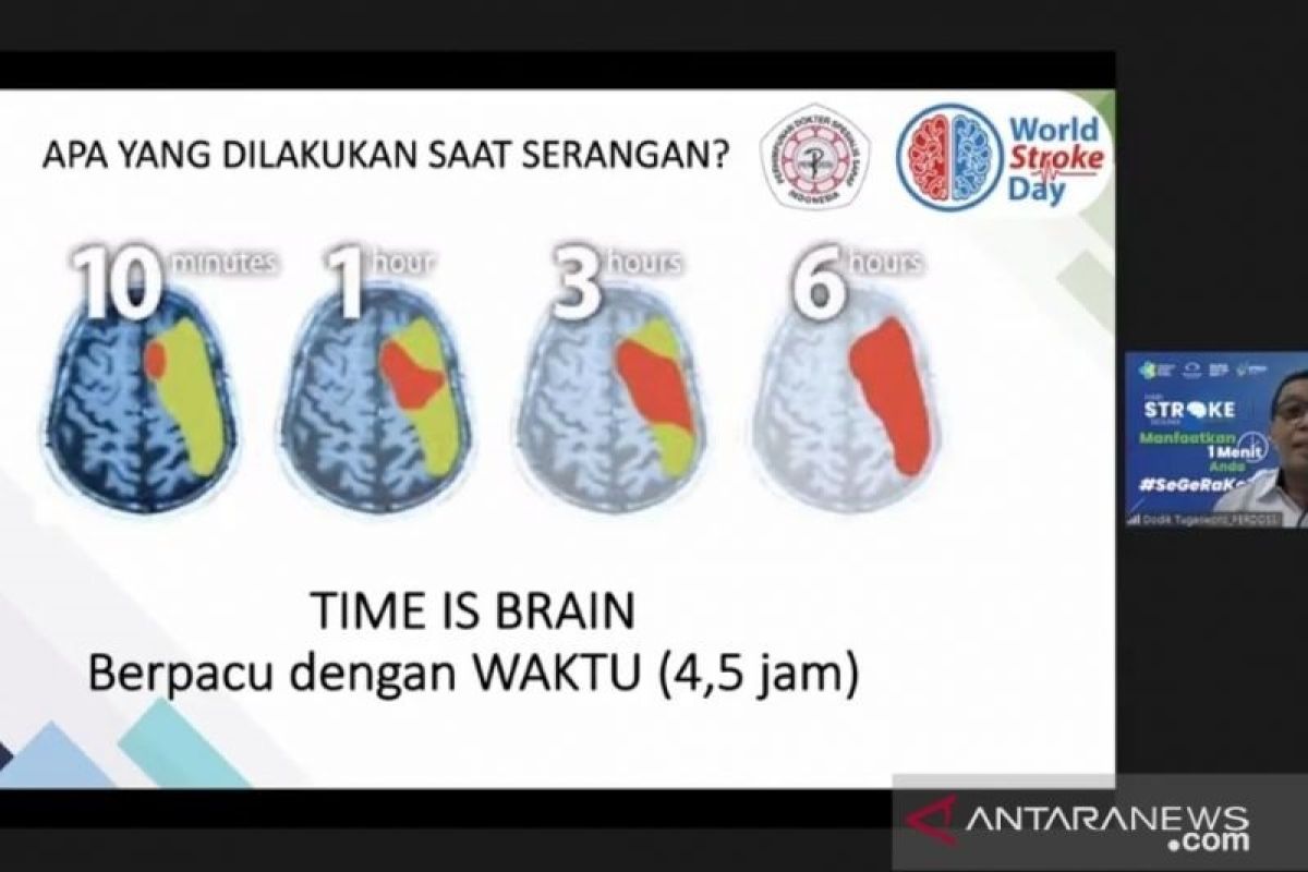 4,5 jam, waktu maksimal untuk selamatkan serangan stroke