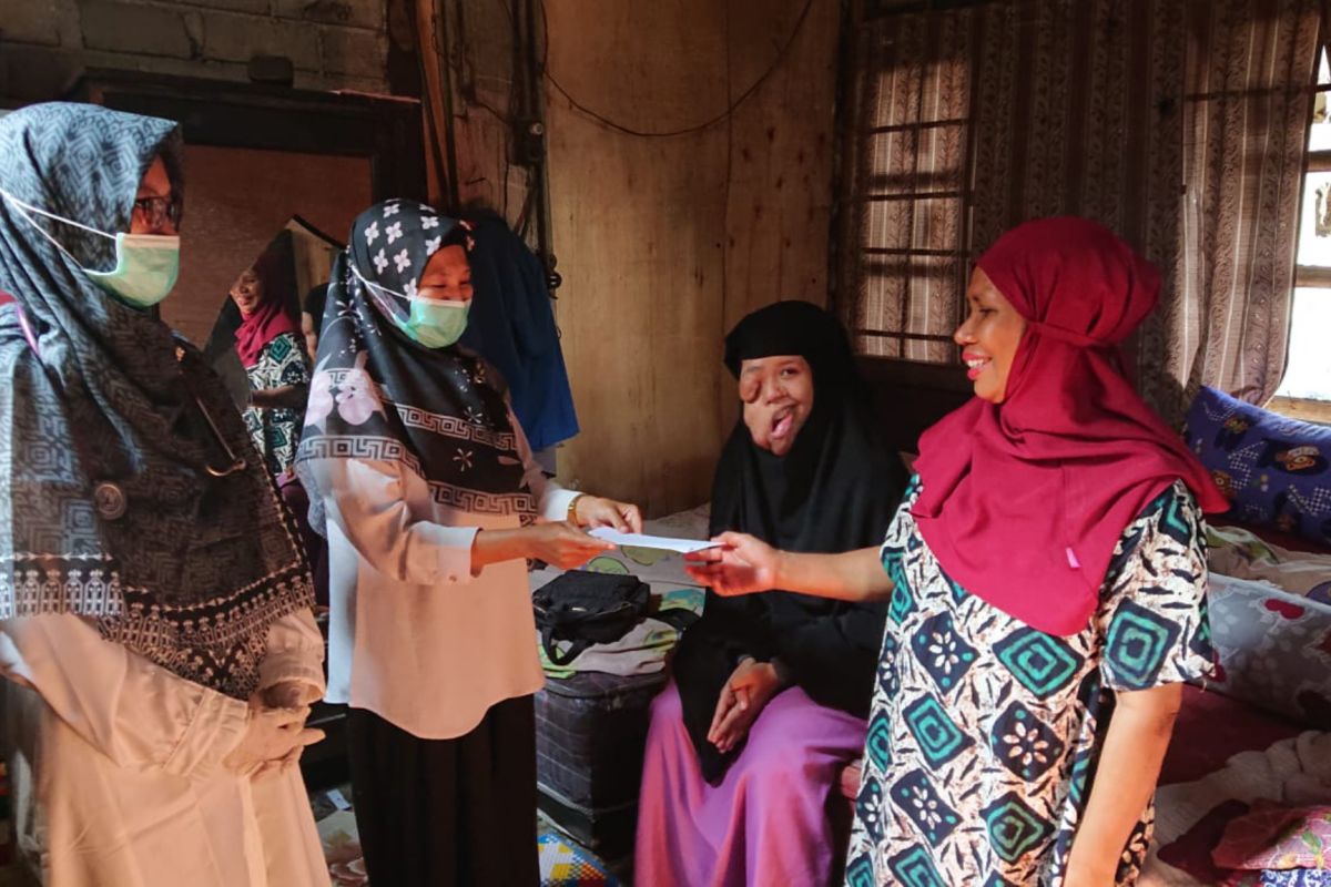 Puluhan tahun gadis Lotim kena tumor kulit menutupi wajah cantiknya, saat ini butuh bantuan