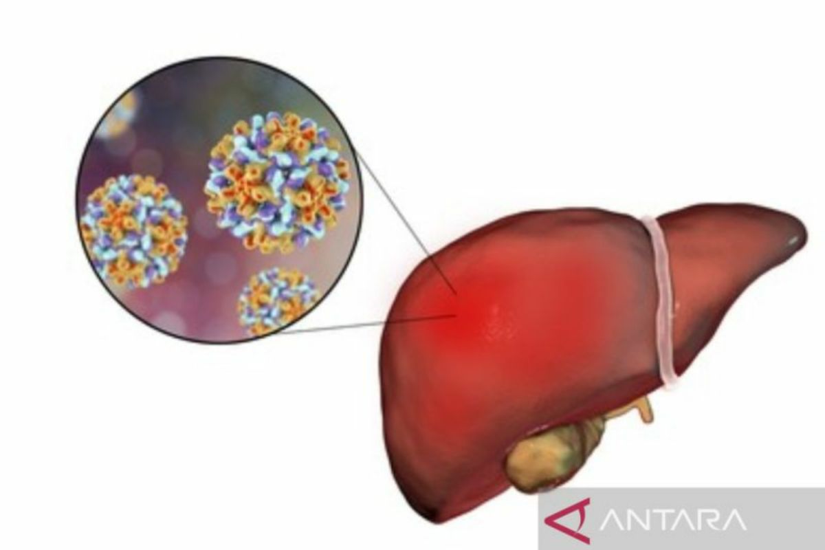 Dinkes Sulteng:  Terapkan prokes ketat cegah hepatitis akut misterius