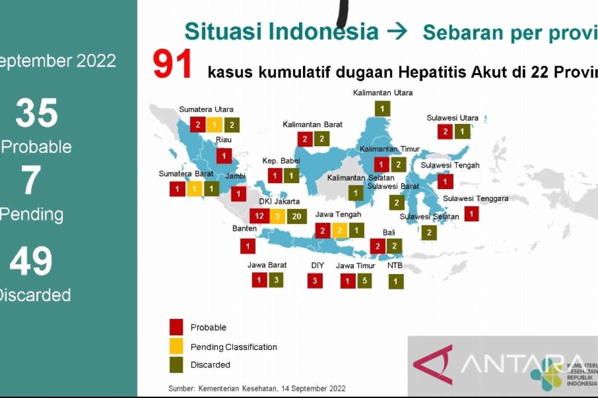 Kemenkes deteksi 91 kasus hepatitis akut misterius