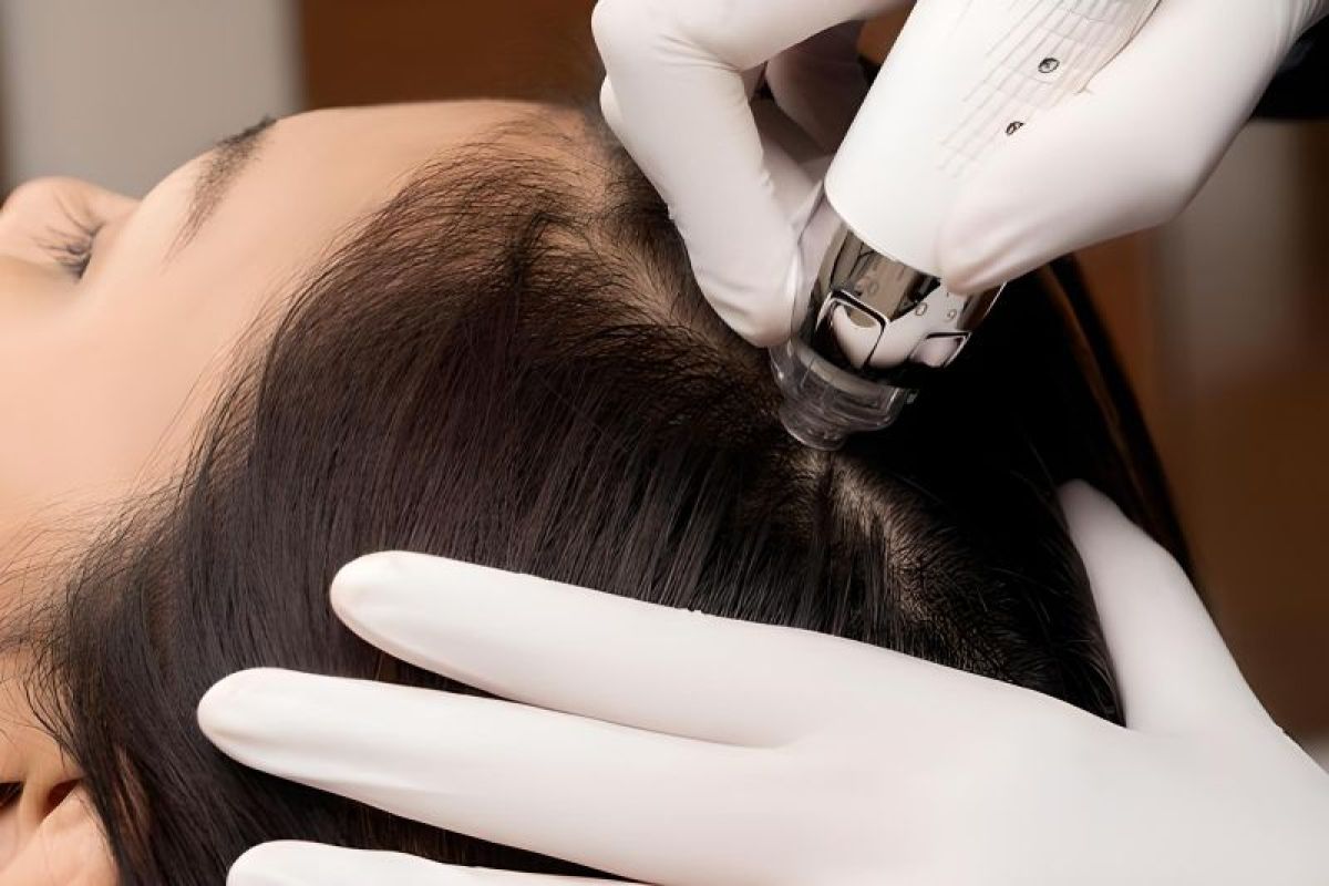 Pijat dan terapi kulit kepala bantu percepat pertumbuhan rambut