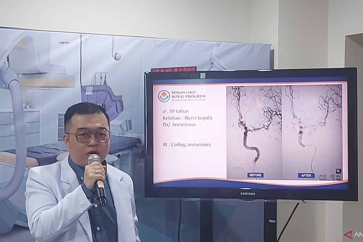 Dokter bisa tekan 'emboli kolesterol' lewat radiologi intervensi