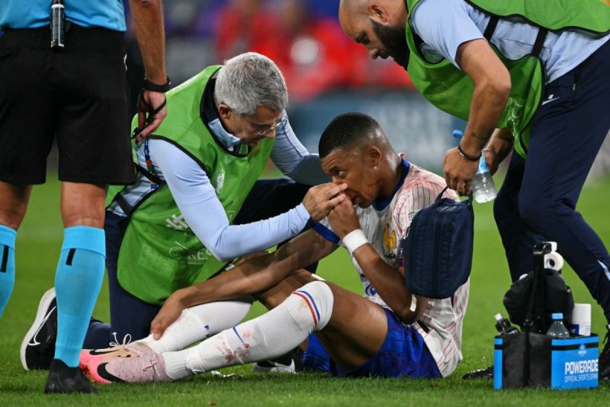 Mbappe cedera patah tulang hidung saat hadapi Austria