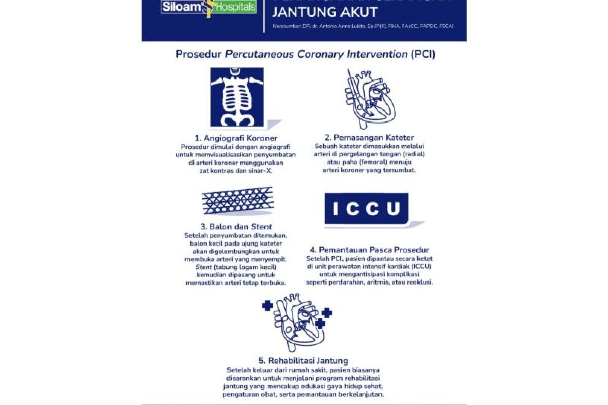 Mengenal gejala dan prosedur PCI serangan jantung akut