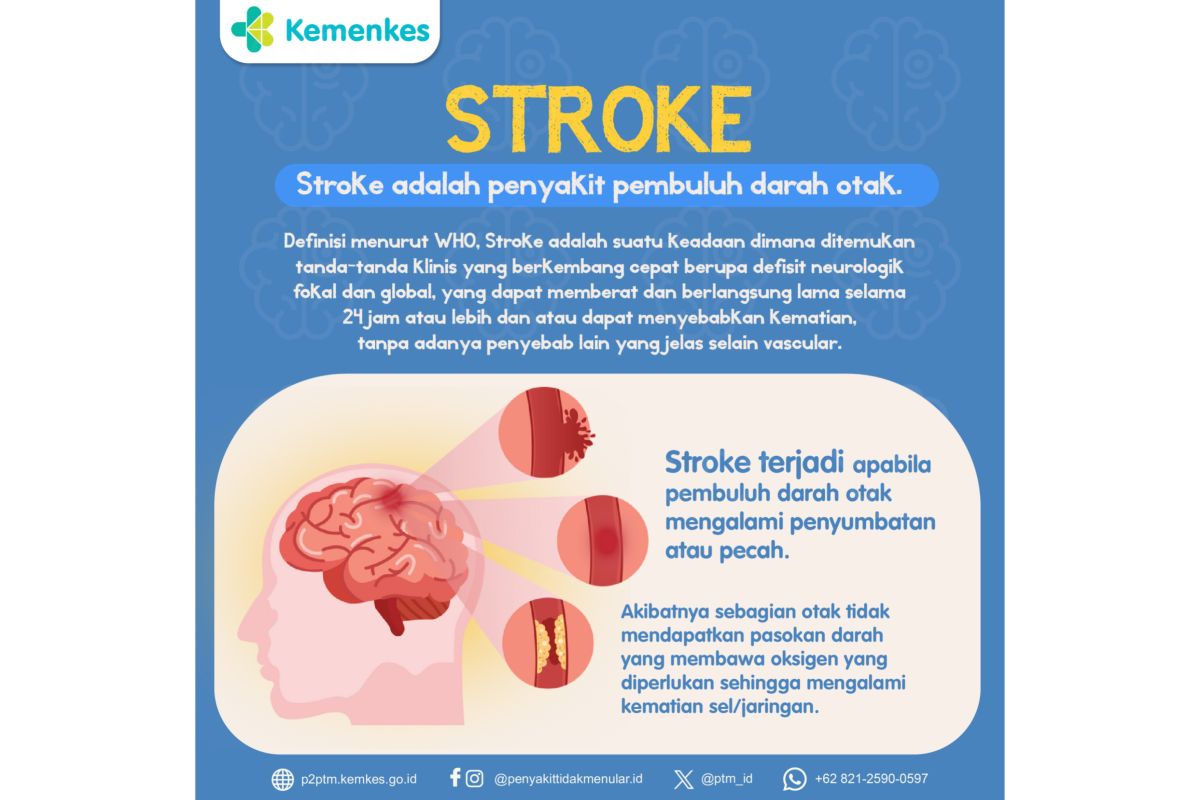 Ahli gizi ingatkan jaga diet sehat guna cegah stroke berulang