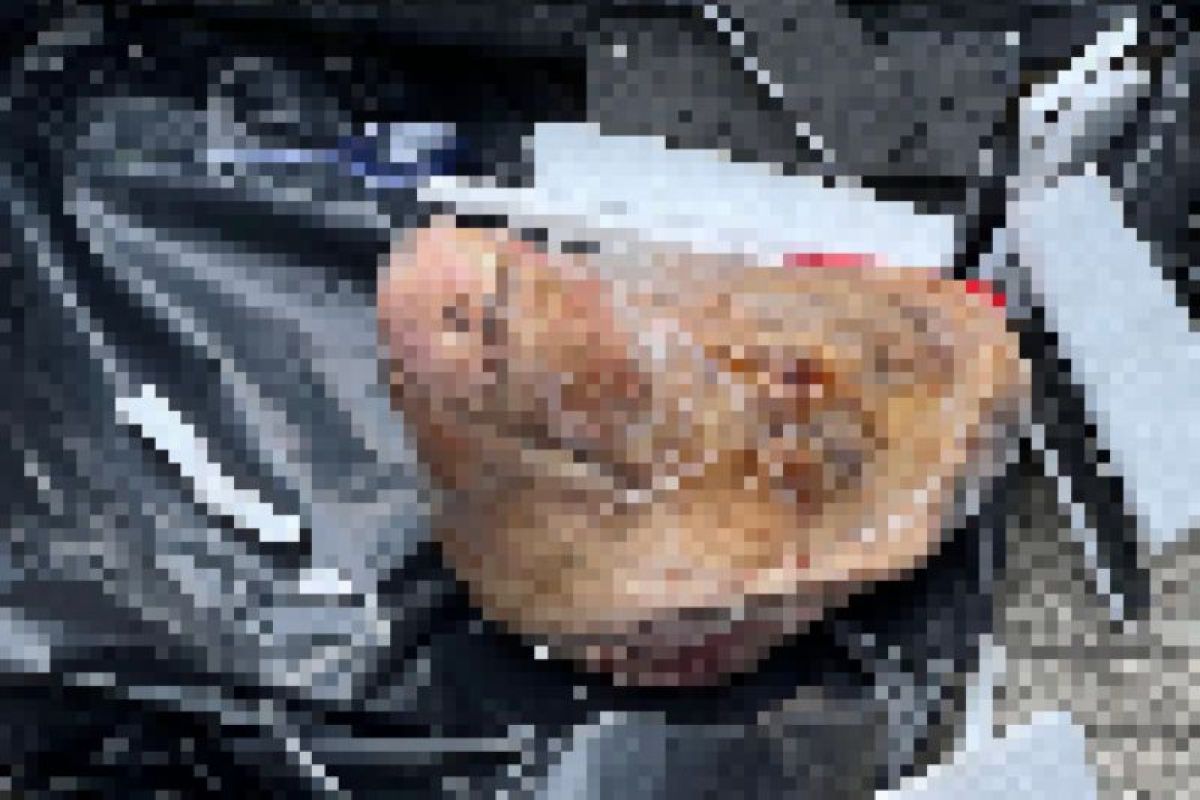 10 kasus ancaman terhadap pers di dunia