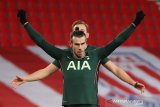 Bale akan absen beberapa pekan akibat cedera