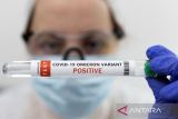 AS terbitkan izin penggunaan darurat tes COVID-19 sampel napas