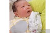 Penyebab dan cara menangani ruam pada area lipatan leher bayi