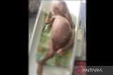 Seorang bayi di Kota Karawang alami gizi buruk