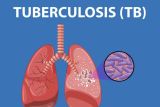 Menarik nafas tanpa takut tuberkulosis di 2030