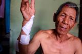 Seorang pria Lampung Selatan terluka akibat diserang buaya