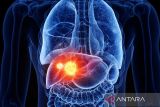 Pentingnya vaksinasi Hepatitis B untuk mencegah kanker hati