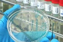 Ilmuwan Rusia kembangkan galur vaksin baru virus Flu Burung H5N1