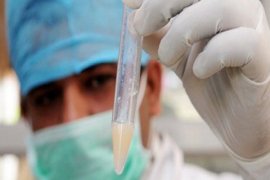 Paparan polusi udara jangka panjang berisiko turunkan kesuburan pria