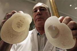 implan payudara di kalangan perempuan