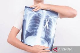 Dinkes Sultra imbau perokok agar berhenti guna mencegah kanker paru