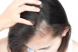 Kebiasaan yang membuat rambut mudah lepek