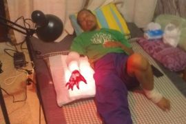 Tangan Linmas Petojo harus diamputasi setelah di bacok pelaku tawuran