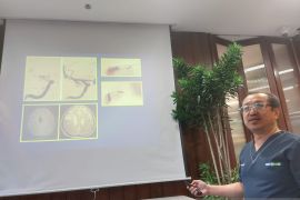 Dokter: Hipertensi hingga kolesterol menjadi penyerta orang kena stroke