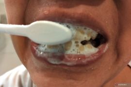 Sikat gigi dua menit setiap hari untuk gusi sehat dan gigi bersih