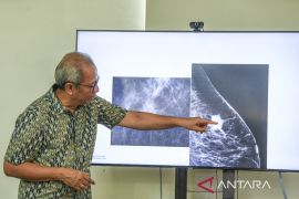Dokter: Waspada ciri-ciri kanker pada perubahan fisik payudara
