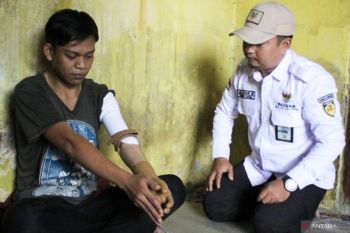 Baznas berikan bantuan lengan prostetik untuk penyandang disabilitas di Bogor