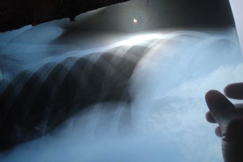 Pakai plastik film rontgen, anak-anak Lampung Timur saksikan Gerhana Matahari Cincin