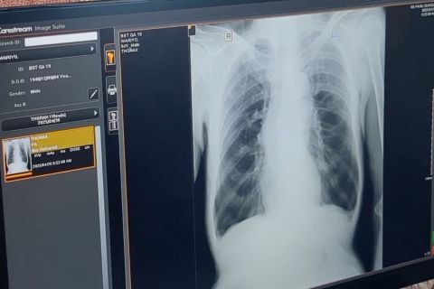 Dinkes Madiun ajak warga antisipasi super flu