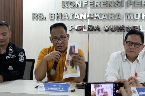 RS Bhayangkara Palembang temukan body part baru korban kecelakaan ALS
