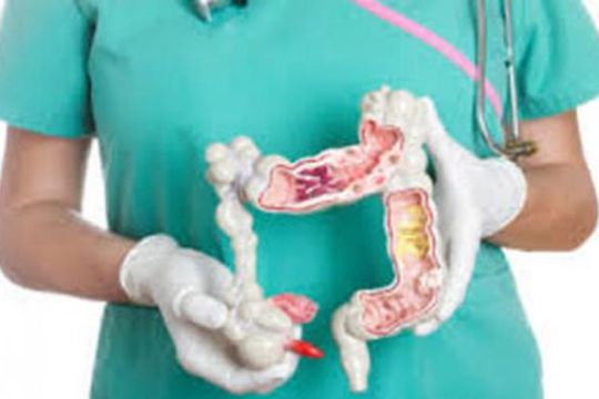 Jenis minuman yang mengurangi risiko terkena kanker usus