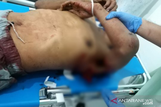 Supir angkot di Medan tewas ditikam karena sabu-sabu