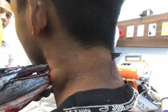 Dokter pantau kondisi pelajar yang diserang ikan cenro