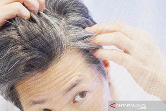 Benarkah rambut beruban tanda pertahanan tubuh terhadap kanker?