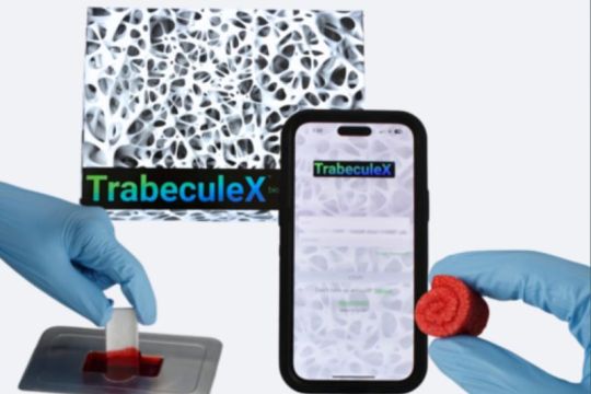 Xenco Medical Luncurkan TrabeculeX Continuum, Sebuah Terobosan Konvergensi Kesehatan Digital dan Biomaterial, di CES 2024 di Las Vegas, Konferensi Teknologi Terbesar di Dunia