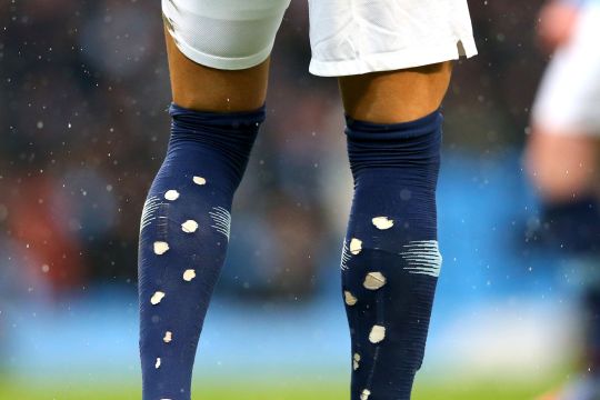 Mengapa pesepak bola saat ini melubangi kaus kakinya? Ini alasannya