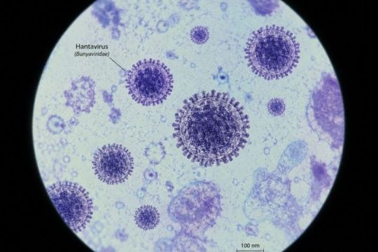 WHO pastikan risiko penyebaran Hantavirus di Kepulauan Canary rendah