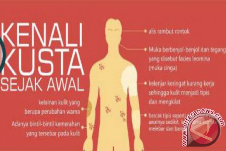 Papua Barat Berjibaku Tekan Kasus Kusta